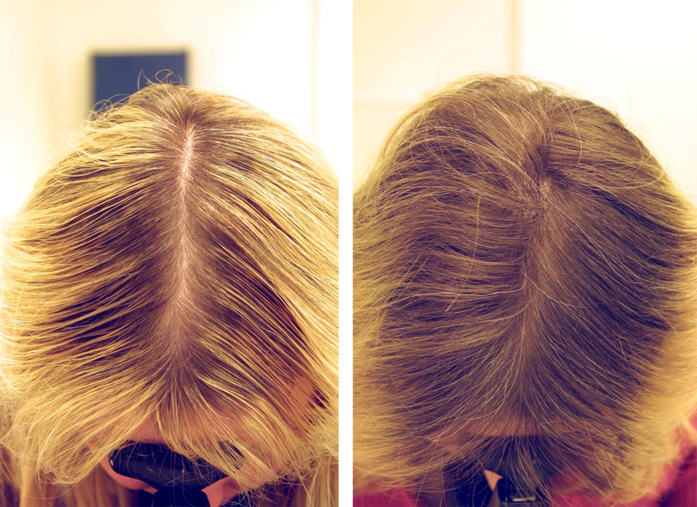 Мумие для волос фото до и после