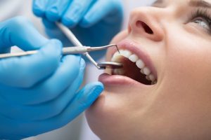 Лечение зубов: с какими проблемами чаще всего обращаются к стоматологу?